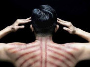 Kerokan, Solusi Mujarab 'Masuk Angin' Orang Indonesia Sehabis Pelesiran