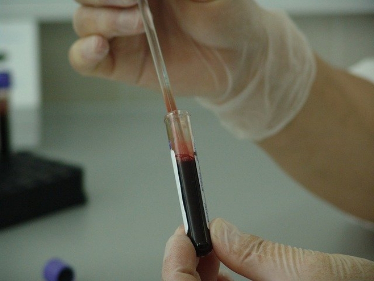 Plasma konvalesen adalah terapi tertua yang dilakukan dokter. (Foto: Pixabay/PublicDomainPictures)