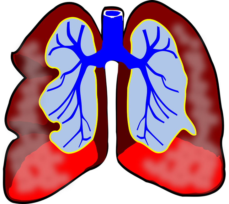 Beta karoten dalam bayam merah efektif mengobati penyakit kronis. (Foto: Pixabay/Clker-Free-Vector-Images)