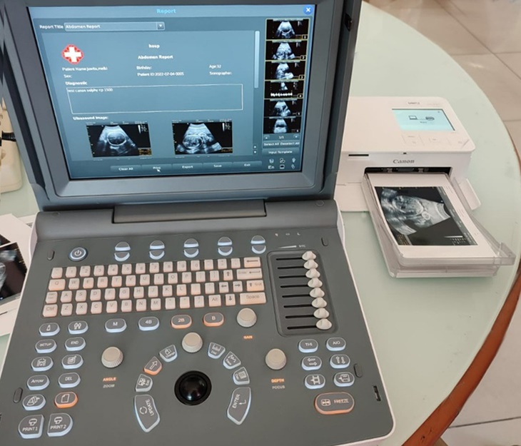 Cetak Foto Berkualitas dengan Portabel Canon SELPHY CP1500