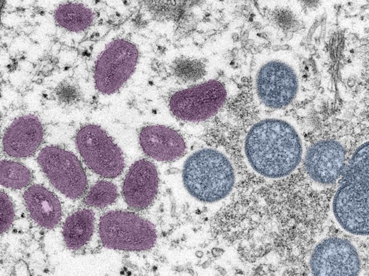 virus