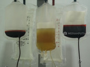 Stok Plasma Konvalesen di PMI Kota Bandung Kini Tersedia, meski Terbatas