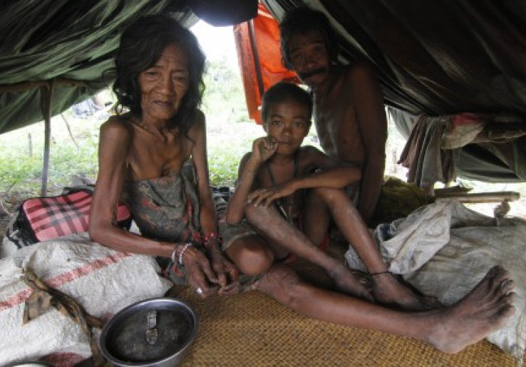 Tas Orang Rimba Jambi Dicolong di RSUD, Duit Rp 45 Juta dan Emas Satu Suku Hilang