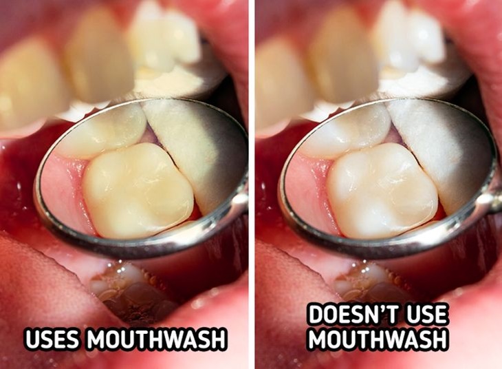 Mouthwash