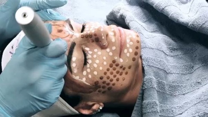 BB Glow, Menyulap Wajah Jadi Flawless Seketika