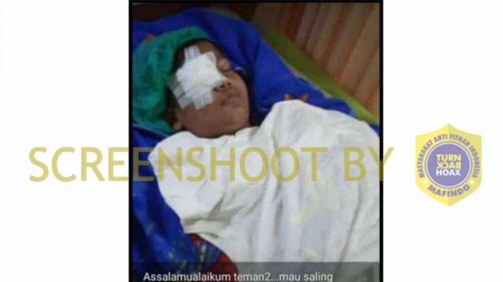 [HOAKS atau FAKTA]: Anak SD Main Lato-Lato hingga Alami Kebutaan