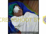 [HOAKS atau FAKTA]: Anak SD Main Lato-Lato hingga Alami Kebutaan