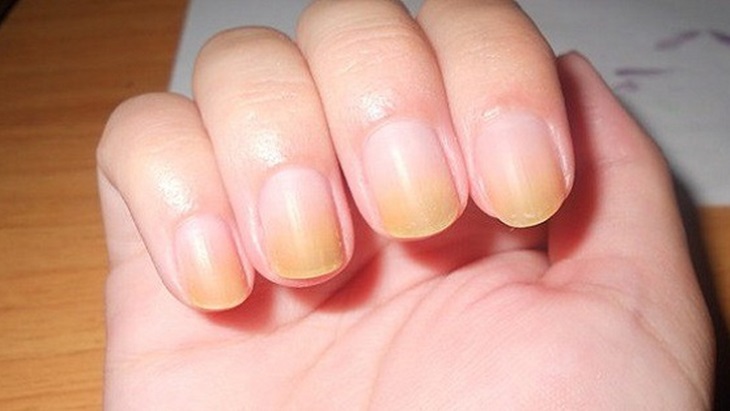 Kuku Kuning, Tak Boleh Disepelekan