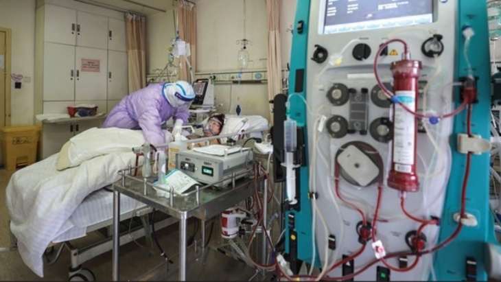 Terapi ECMO Kurangi Risiko Kematian Pasien COVID-19