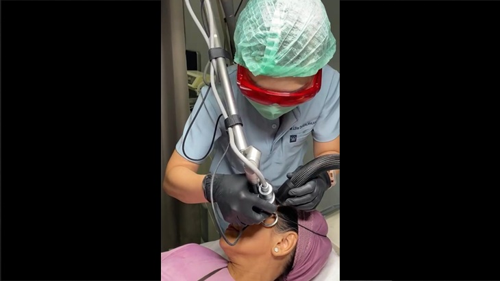 Filmda yalangoch Alika Smexova Ginekolog da yashirin kamera porno video