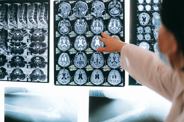 brain