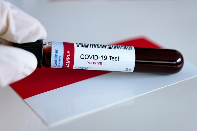 Update COVID-19 di DKI Minggu (12/4): 1.903 Positif dan 142 Pasien Sembuh