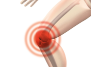 Hati-Hati, Kegemukan Dapat Menyebabkan Osteoarthritis