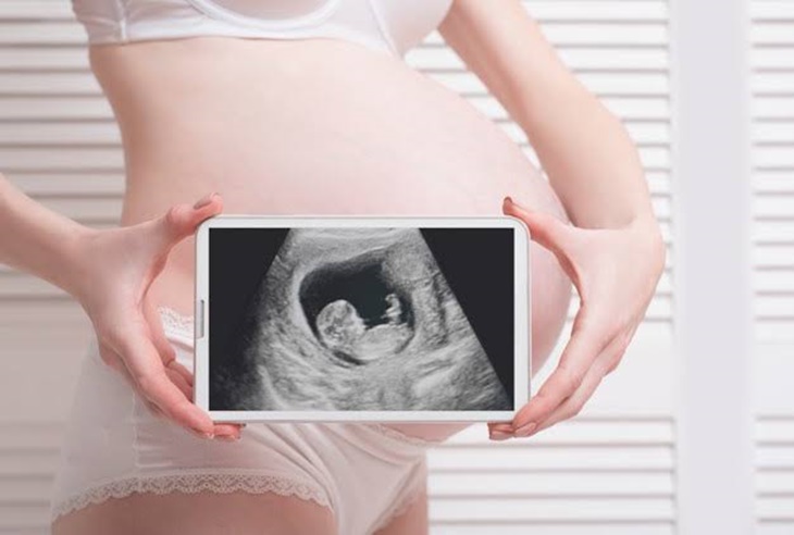 Bukan Karena Corona, Faktor ini yang Buat Angka Kematian Ibu dan Janin Meningkat