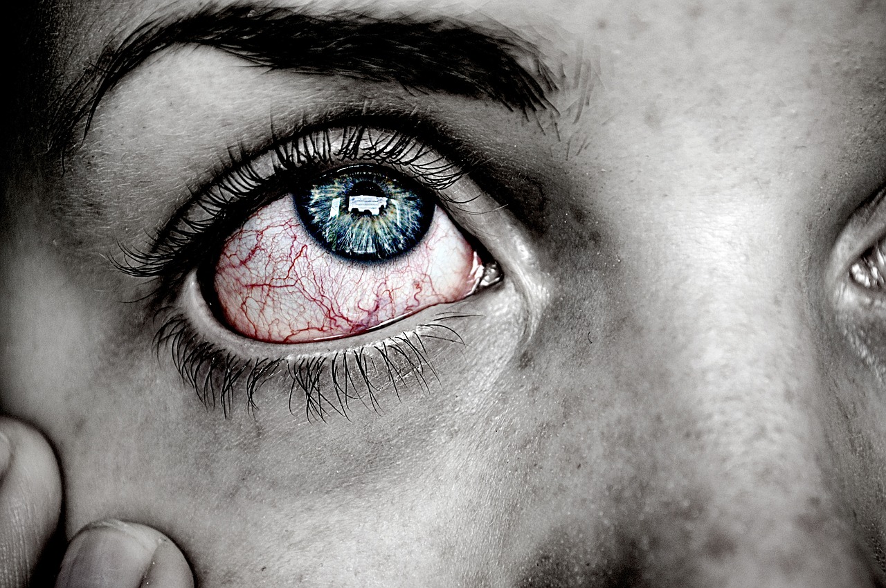 Mata merah (Sumber: Pixabay/agnesliinnea)
