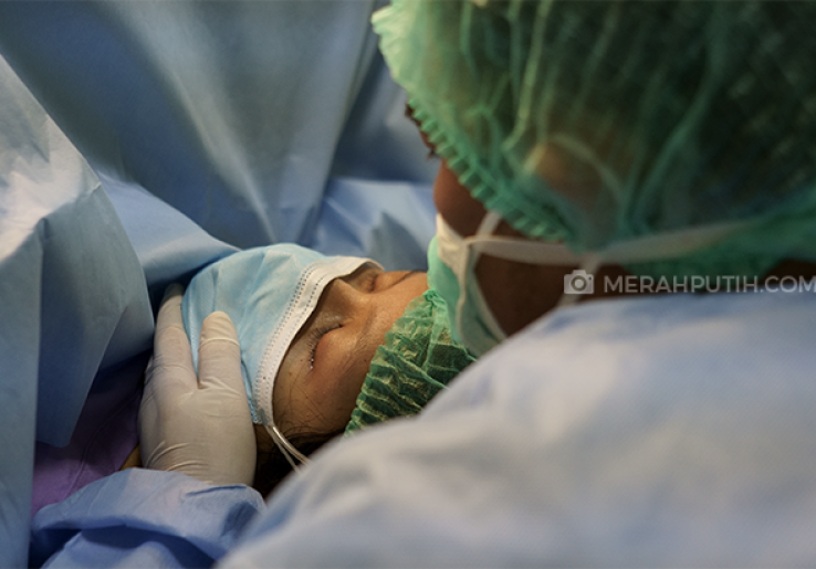 Mendamaikan Diri Saat Jadi Korban Momshaming Akibat Operasi Caesar