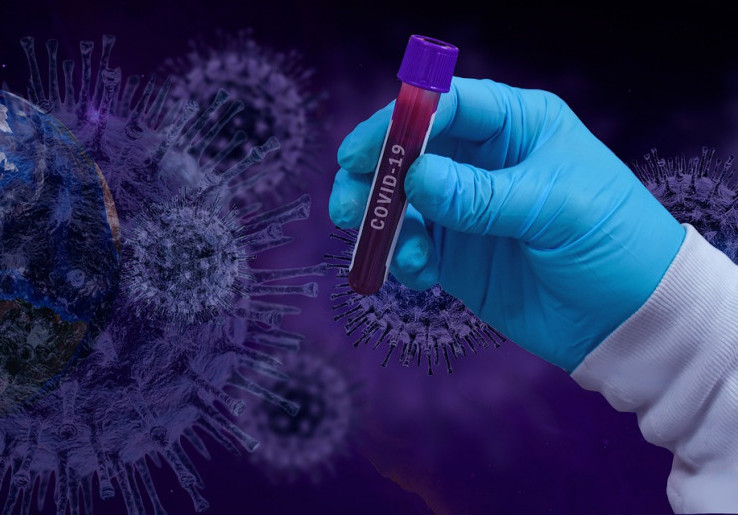  Ilmuwan China Temukan Virus Corona Kelelawar Baru yang Sama dengan COVID-19, Disebut Dapat Menular ke Manusia Lewat