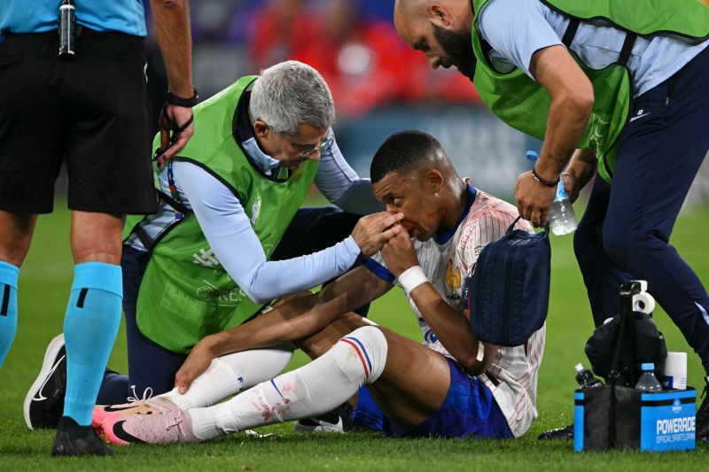 Hidung Kylian Mbappe Patah, Tampil Bertopeng di Laga Prancis Berikutnya
