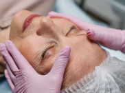 Perhatikan Hal ini Sebelum Melakukan Microneedling di Rumah