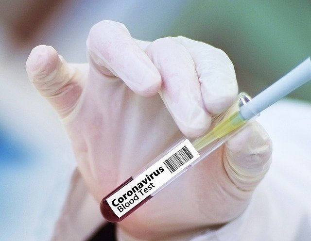 Vaksinasi COVID-19 Gratis Dilakukan di Puskesmas