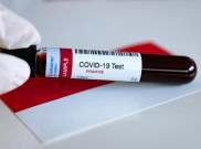 Update COVID-19 DKI Selasa (7/4): 1.395 Positif, 795 Orang Menunggu Hasil Lab