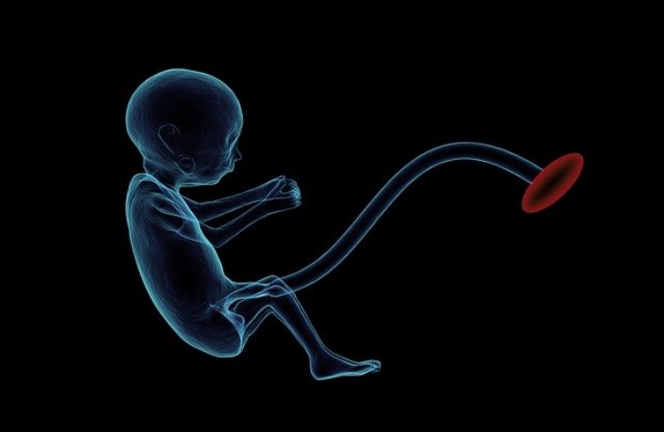 Bayi bisa sewaktu-waktu terlilit placenta. (Foto: Pixabay/sbtlneet)