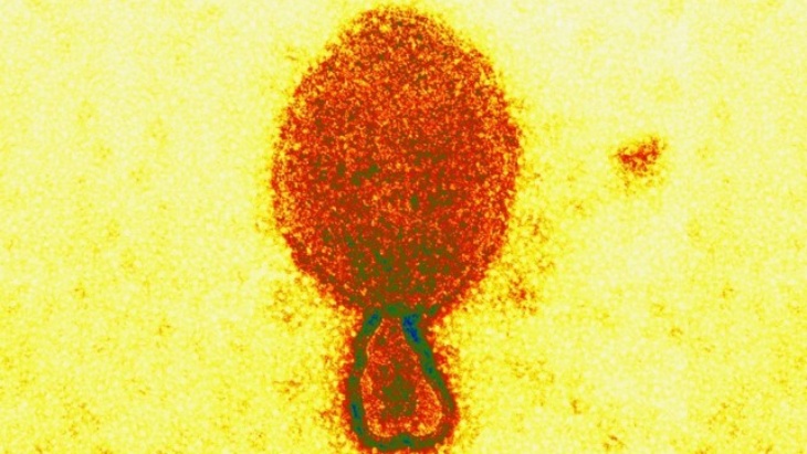 Waspada Zoonosis, Peneliti di Australia Temukan Varian Baru Virus Hendra