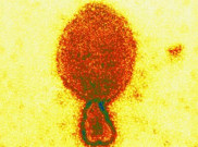 Waspada Zoonosis, Peneliti di Australia Temukan Varian Baru Virus Hendra