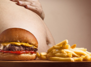 Nah Lo, Tetangga Bisa Jadi Penyebab Obesitas