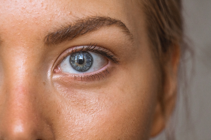Retinol mampu memudarkan noda hitam pada wajah. (Foto: Unsplash/Amanda Dalbjorn)