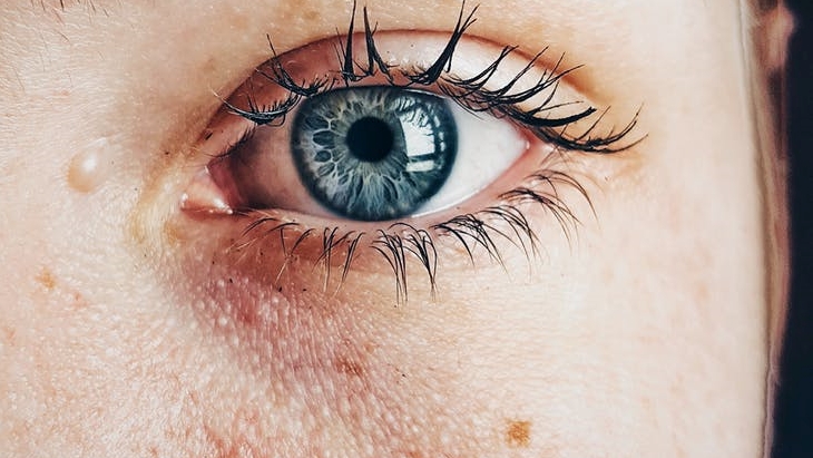Selain itu, dapat membuat mata menjadi iritasi dan meradang. (Foto: unsplash/DhyamisKleber)