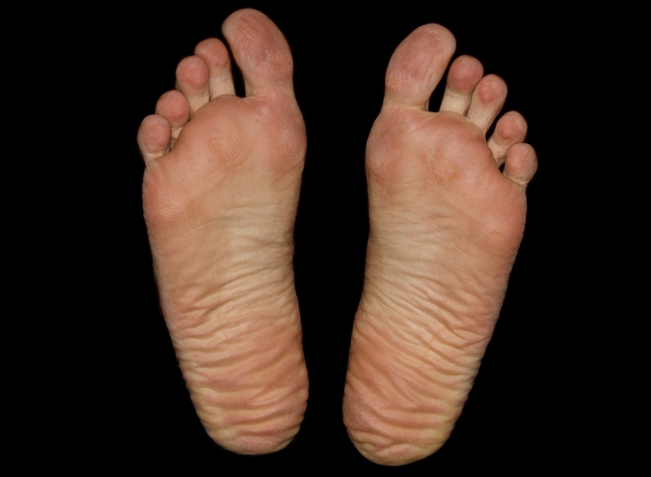 Tubuh bisa mengalami pembengkakan di beberapa area. (Foto: Pixabay/PaintedFeet01)