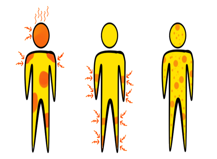 DBD dapat didiagnosis dengan banyak tanda. (Foto: Pixabay/JFJunior)