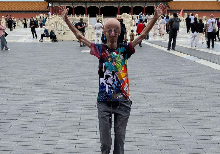 Kisah Sammy Basso: Perjalanan Penelitian untuk Menemukan Pengobatan Progeria