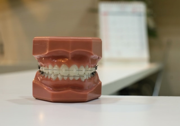 Gingivitis merupakan penyakit gusi yang cukup parah. (Foto: Unsplash/Yingpis Kalayom)