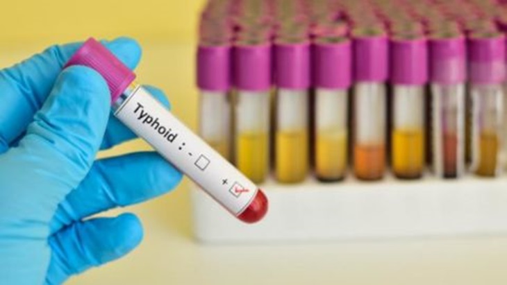 Penyakit Typhoid. (Foto/konbini.com)