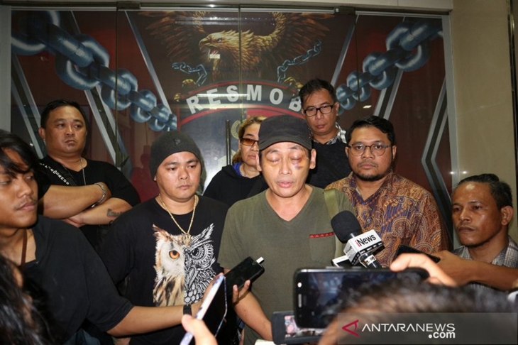 Ninoy Karundeng (tengah). ANTARA/Fianda Rassat