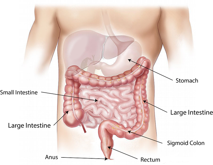 Es teh manis berlebihan bisa berdampak pada pencernaan. (Foto: Pixabay/bodymybody)