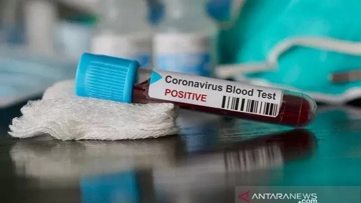 Kelengahan Pemprov DKI Awasi Tempat Hiburan Picu Lonjakan Kasus COVID-19