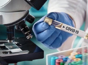  [HOAKS atau FAKTA]: Kelinci Percobaan Vaksin Corona Meninggal Sehabis Dites