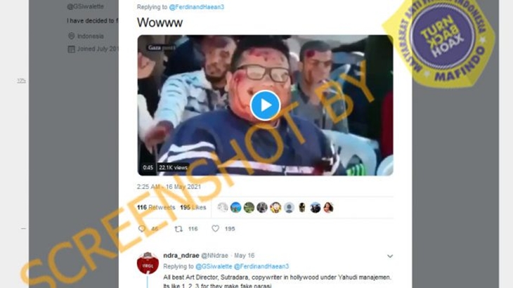 [HOAKS atau FAKTA]: Luka Warga Palestina akibat Serangan Israel Hasil Make Up