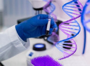 Inovasi Terbaru Management Kolestrol Lewat Tes DNA