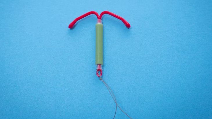 Jangan Ragu Tunda Kehamilan dengan IUD