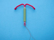 Jangan Ragu Tunda Kehamilan dengan IUD