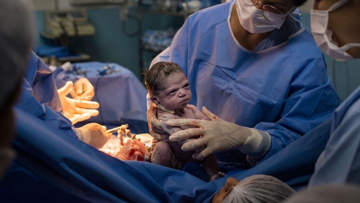Viral! Ekspresi Wajah Bayi Baru Lahir ini Hebohkan Internet
