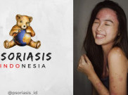 Pemuda Penyintas Autoimun Negeri Aing Hapus Stigma Negatif Psoriasis Lewat Kampanye  Se-Asia Tenggara