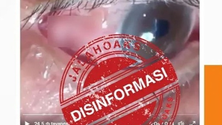 [HOAKS atau FAKTA]: Cacing Parasit di Dalam Mata akibat Vaksin COVID-19
