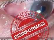 [HOAKS atau FAKTA]: Cacing Parasit di Dalam Mata akibat Vaksin COVID-19