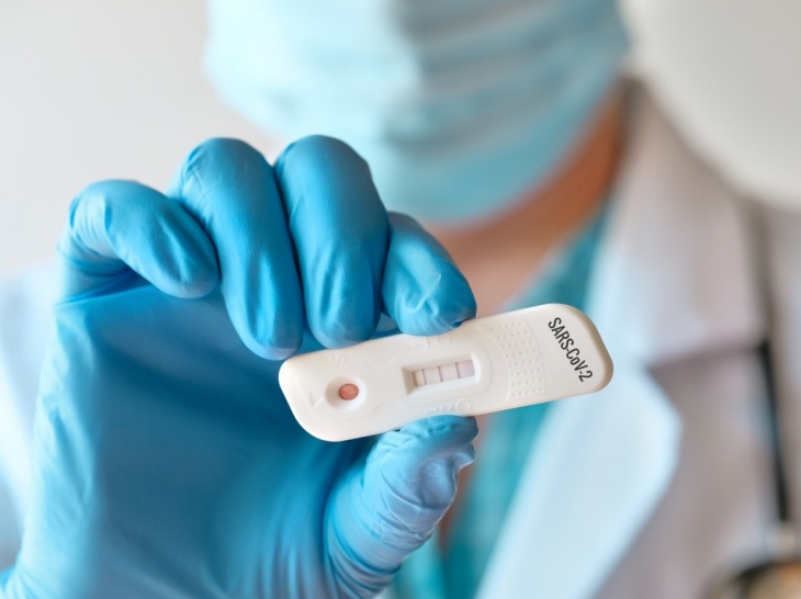 Rapid Test Antibodi (Foto: 123RF/Anna Ivanova)
