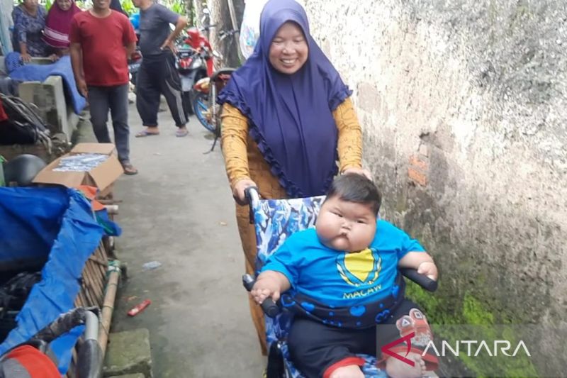 Balita Obesitas di Bekasi Dirujuk ke RSCM Jakarta